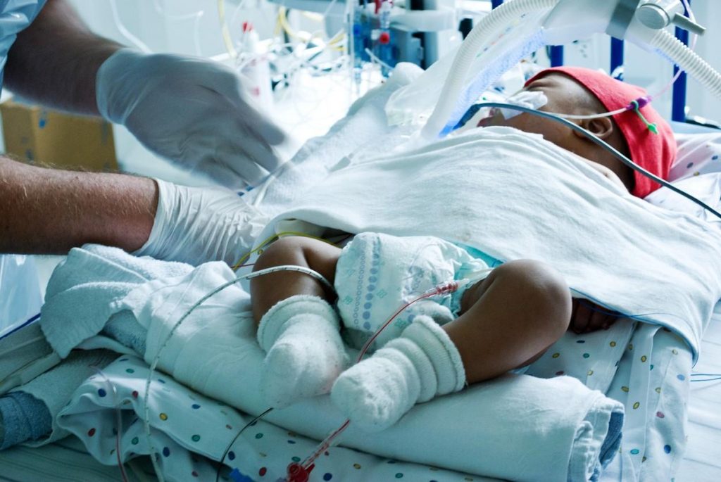 Study: 81% of infants in ICU for RSV were previously healthy, born full-term (By:Mary Van Beusekom, MS)