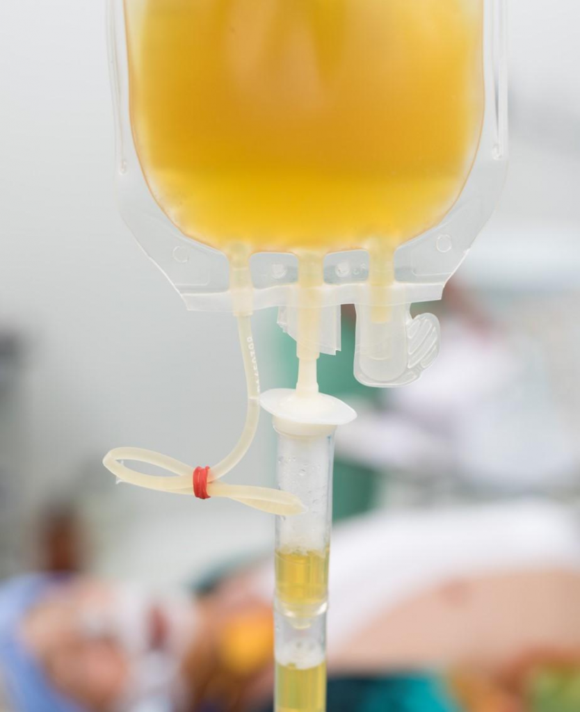 Convalescent plasma cuts death by 10% in COVID patients on mechanical ventilation, trial finds (By: Mary Van Beusekom, MS)