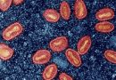 Mpox spread via nonsexual contact not common, new data show