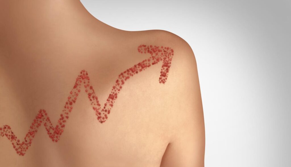 US measles cases hit 4,588, more than twice last year’s total -Chris Dall, MA Liz Szabo, MA